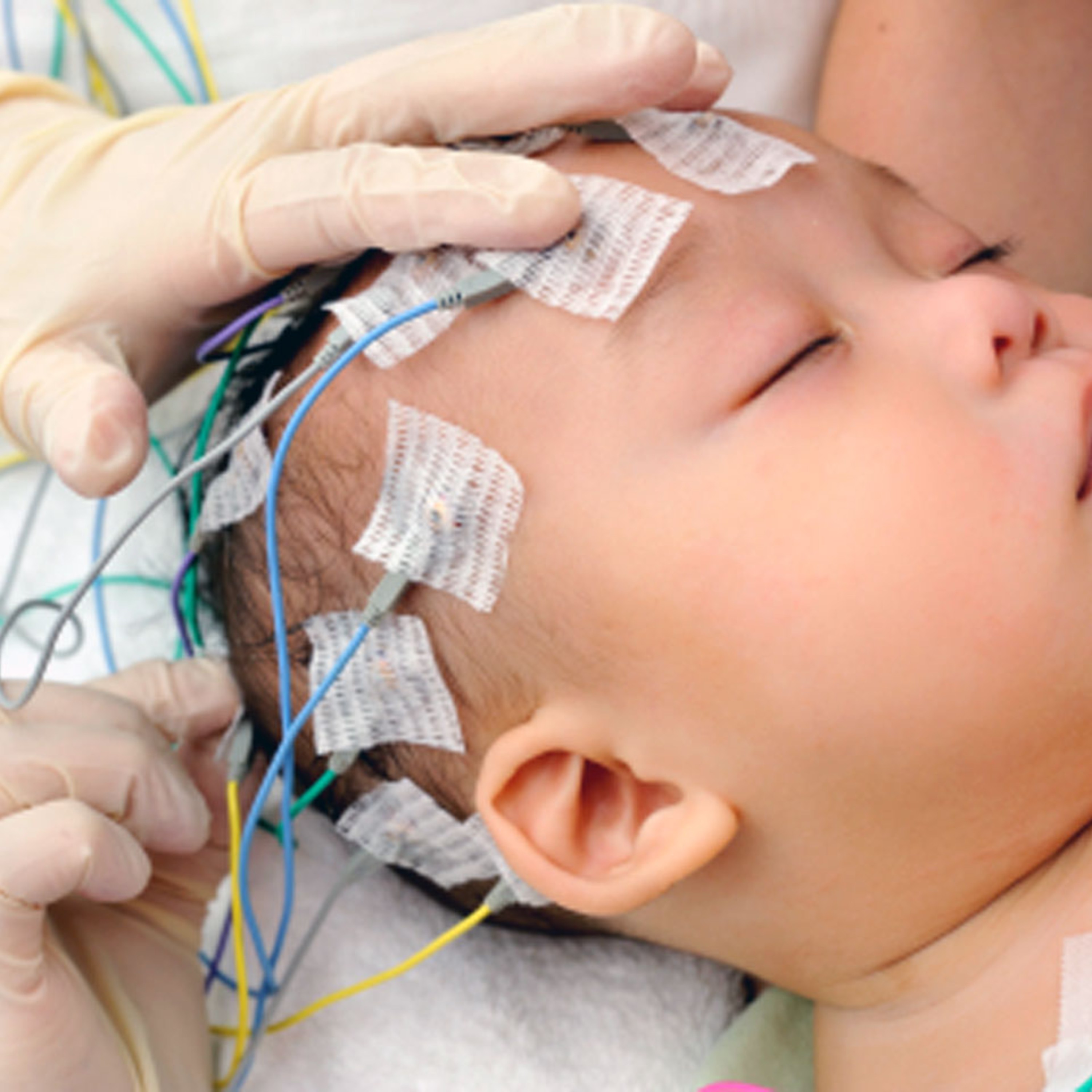 Pediatric Neurological Conditions episode artwork